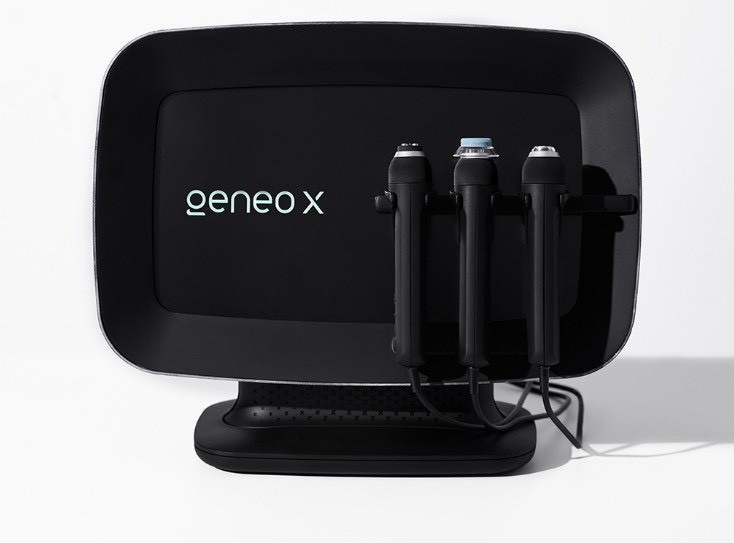 ジェネオエックスとは？